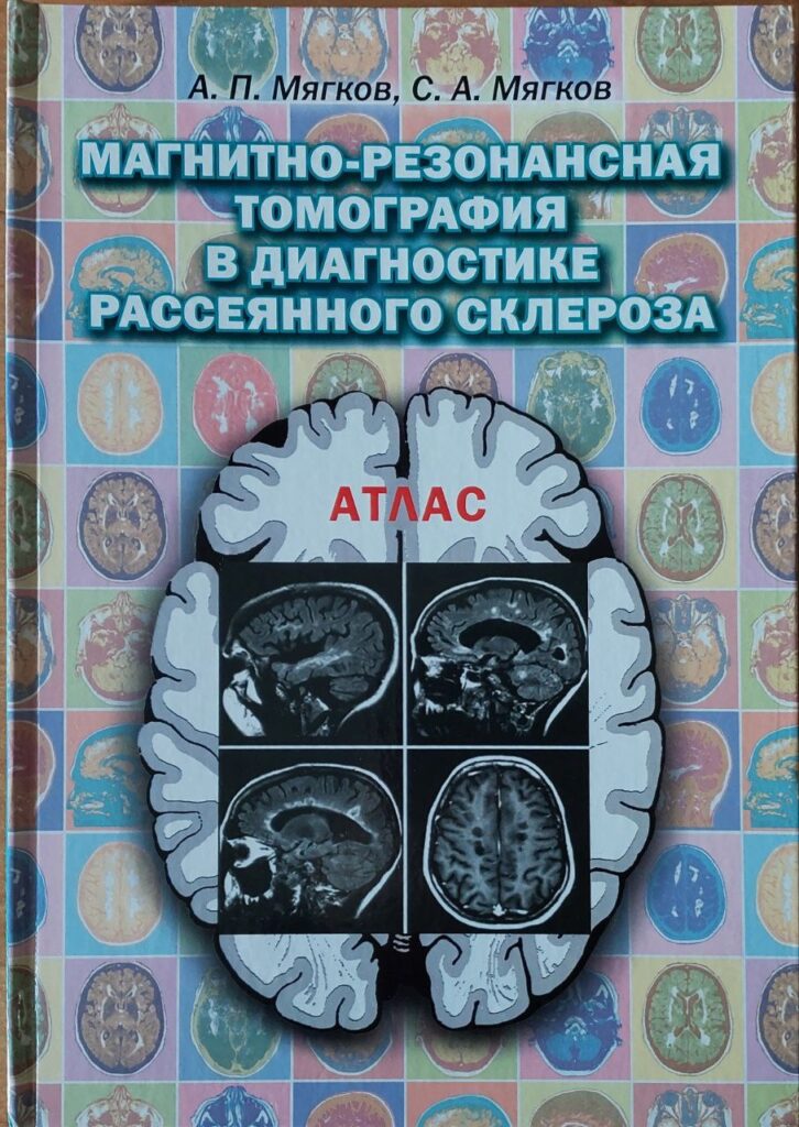 Магнітно-резонансна томографія у діагностиці розсіяного склерозу